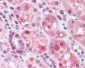 DNMT / DNMT1 Antibody (Internal)